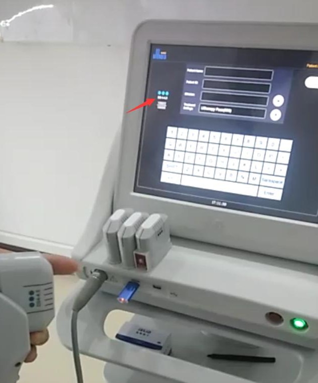 HIFU High Intensity Focused Ultrasound machine